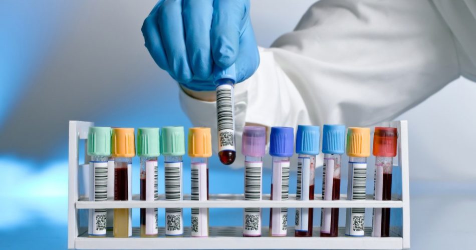 анализы на гепатит С